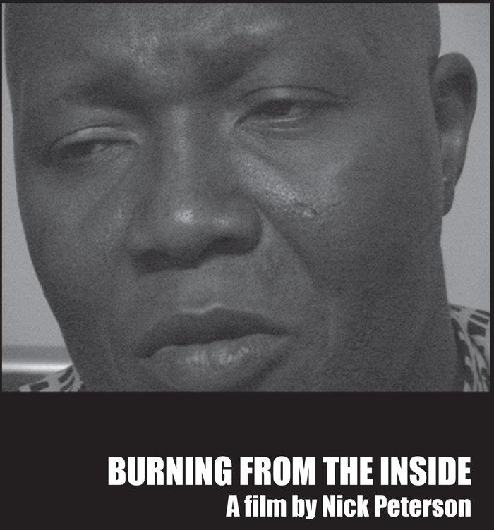 Burning from the Inside